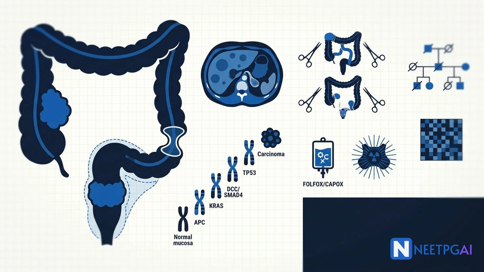 Colorectal Cancer Management for NEET PG 2026
