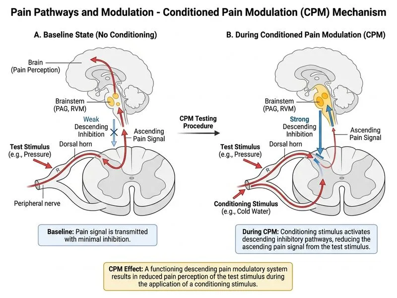 Pain Pathways and Modulation diagram