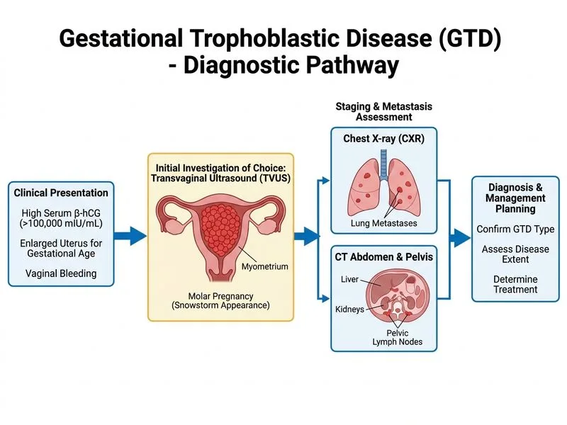 Gestational Trophoblastic Disease diagram