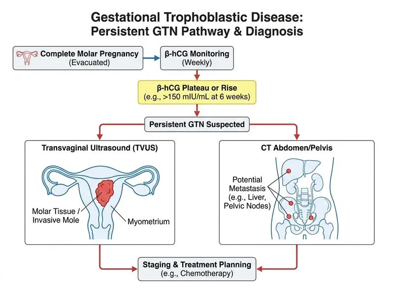 Gestational Trophoblastic Disease diagram