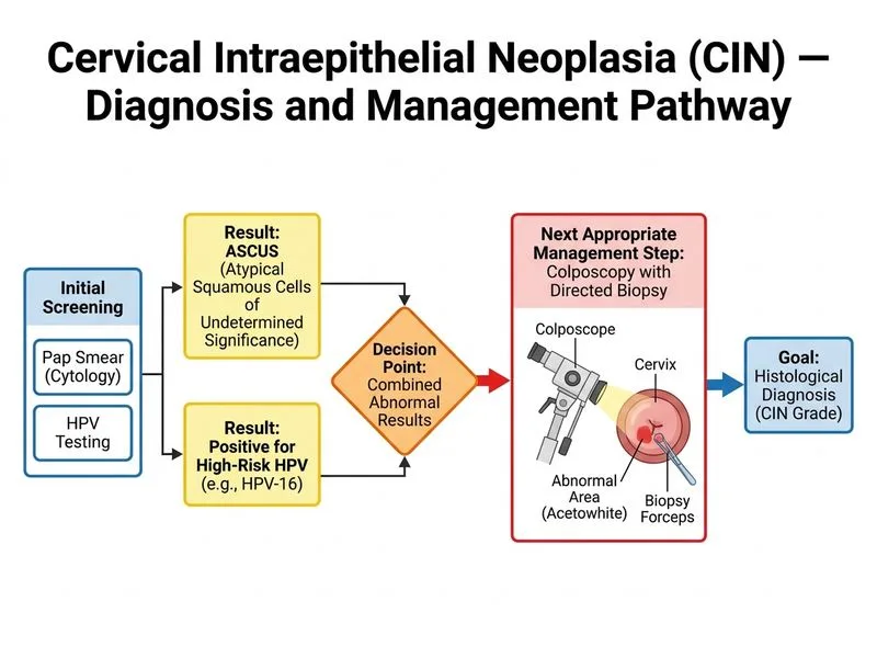 Cervical Intraepithelial Neoplasia (CIN) — Diagnosis and Management diagram