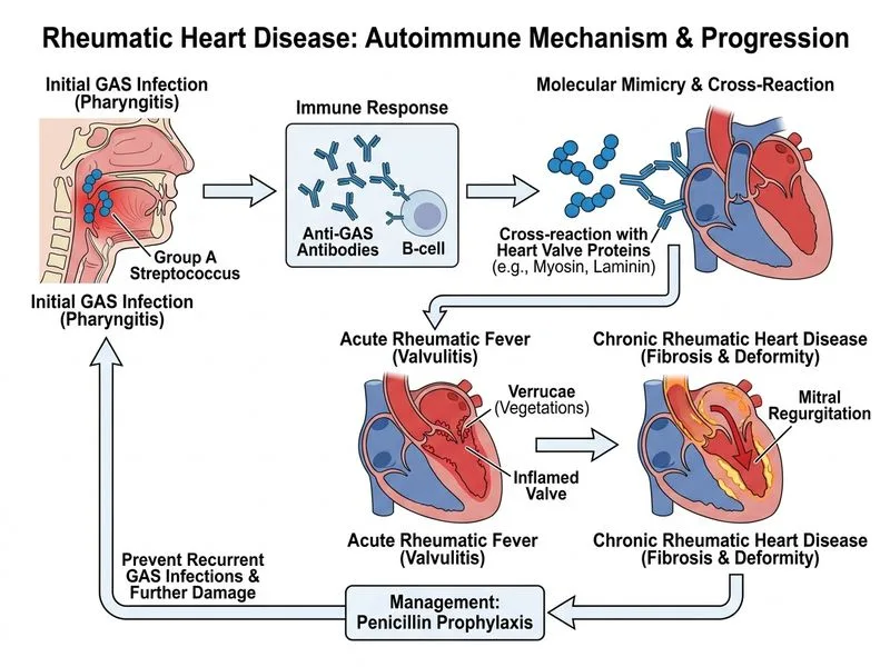 Rheumatic Heart Disease diagram