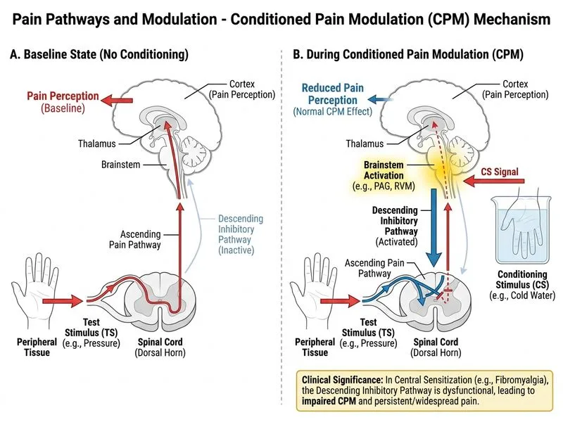 Pain Pathways and Modulation diagram