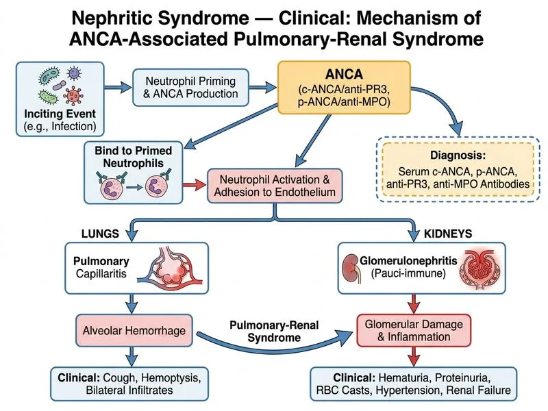 Nephritic Syndrome — Clinical diagram