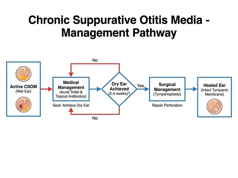 Chronic Suppurative Otitis Media diagram