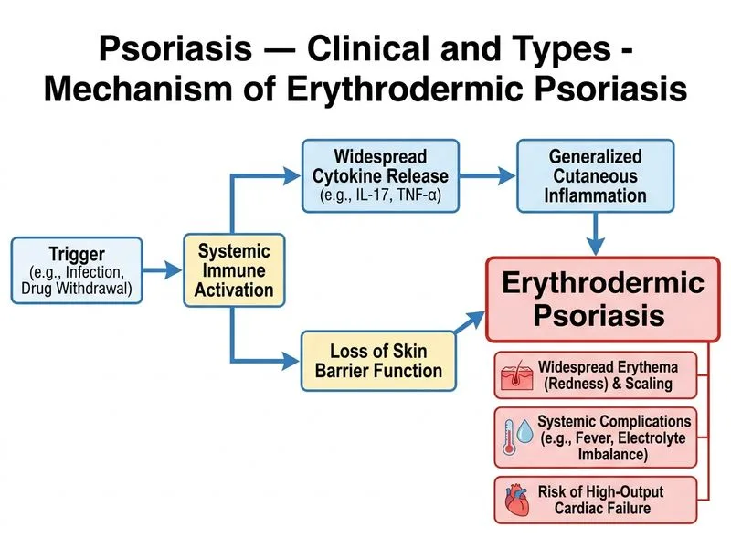 Psoriasis — Clinical and Types diagram