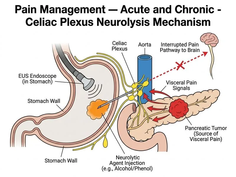 Pain Management — Acute and Chronic diagram