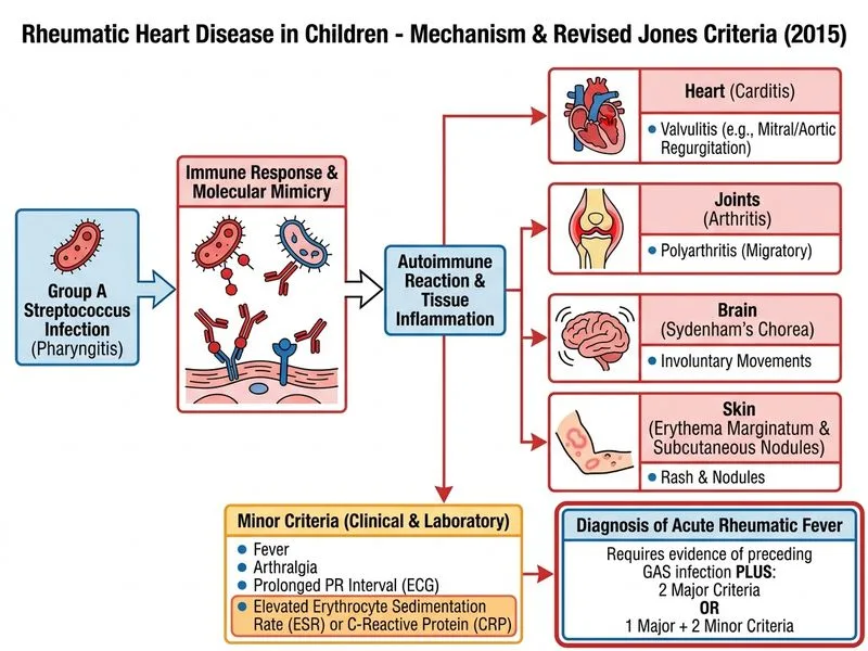 Rheumatic Heart Disease in Children diagram