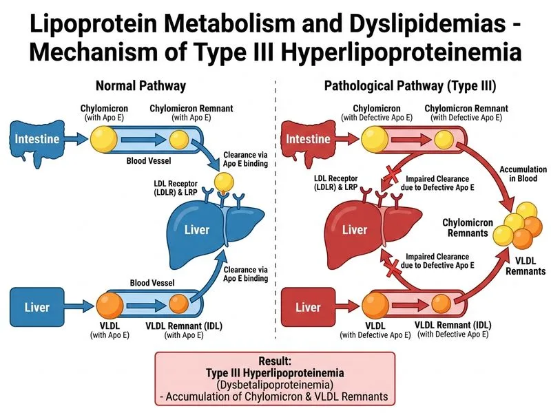 Lipoprotein Metabolism and Dyslipidemias diagram
