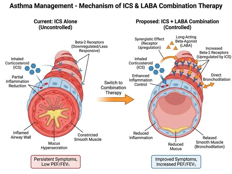 Asthma Management diagram